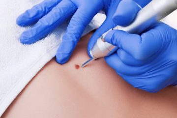 Morrinhos ultrapassa a marca de 1.300 pequenas cirurgias realizadas na atual gestão